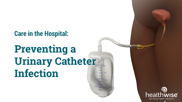 How to Care for Your Urinary Catheter